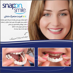 فروش ویژه لمینت متحرک دندان - Snap On Smile
