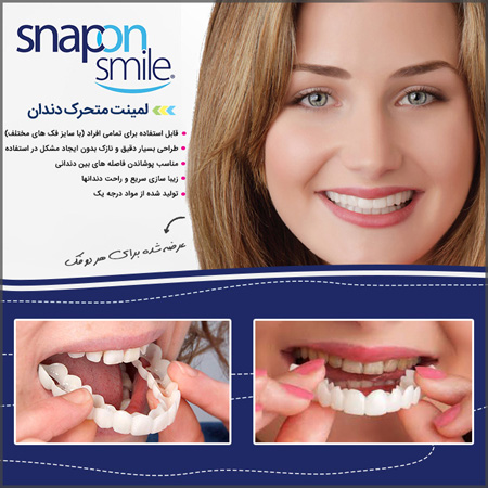فروش ویژه لمینت متحرک دندان - Snap On Smile 1 فروش ویژه لمینت متحرک دندان - Snap On Smile